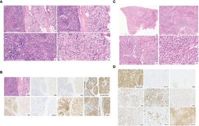 Case report: Potential role of immunotherapy in thymic malignancies: a unique case of a durable and complete response upon an immune checkpoint inhibitor